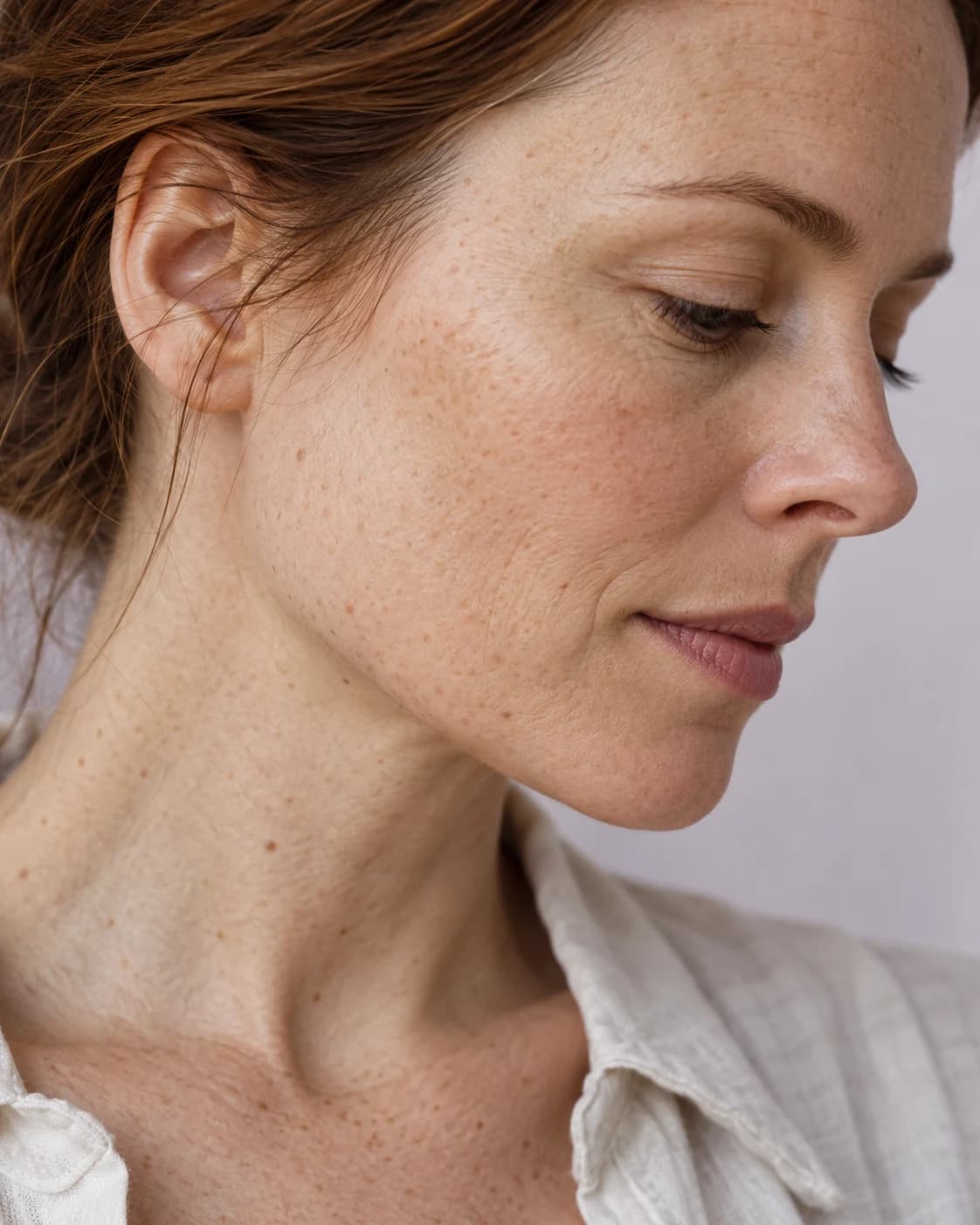 Editorial detail of freckled skin in natural window light