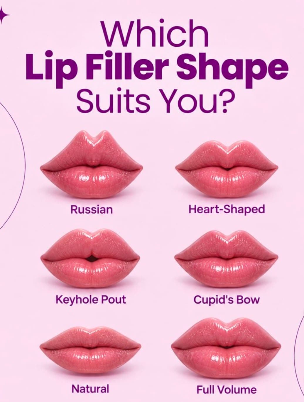Which Lip Filler Shape Suits You? Comparison of Russian, Heart-Shaped, Keyhole Pout, Cupid's Bow, Natural, and Full Volume lip filler shapes at Kosit Aesthetics Clinic